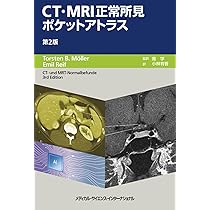 【裁断済】　産婦人科の画像診断 第2版　2025年10月発売　最新版 産婦人科の画像診断 第2版 | 田中 優美子 |本 | 通販 | Amazon
